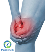 Slider image (4) MexStemCells Clinic